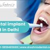 Understanding Dental Implants: A Comprehensive Guide