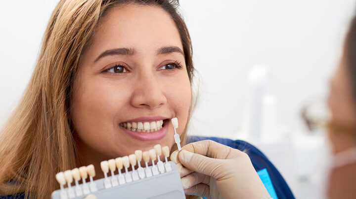What Does It Involve In The Dental Veneer Procedure? 