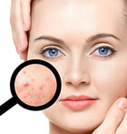 5 essential tips on choosing the best dermatologist