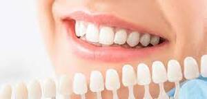 Are You a Good Candidate for Dental Implants?