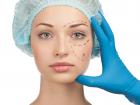 Bad Cosmetic Surgery: Beware Of The Pitfalls