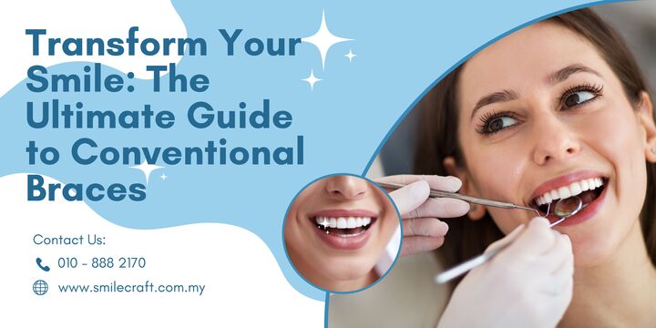 Transform Your Smile: The Ultimate Guide to Conventional Braces