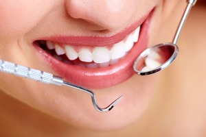 What Are The Beneficial Aspects Of Dental Implants? 