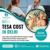 TESA Cost In Delhi
