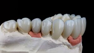 Quels sont les avis des patients sur Dentisterie esth\u00e9tique Gen\u00e8ve\u202f?