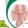 Ayurvedic Remedies for Rectal Prolapse: Herbal Medicine Natural Healing