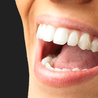 What Are The Types Of Dental Implants?