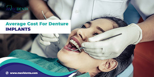 The Average Cost For Denture Implants