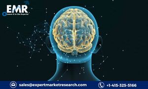 Central Nervous System Treatment Market Key Players, Size, Share, Demands, Trends, Growth Rate and Forecasts 2023-2028