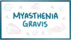 Myasthenia Gravis: A Severe Neuromuscular Disease
