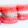 What You Should Know About Dental Implants Procedure?