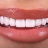 What Are The Steps To Fill Teeth?