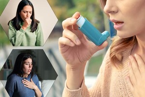 How to Determine If You Have Asthma