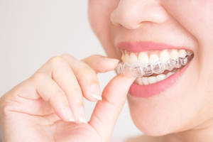 What Does Invisalign Treatment Do?
