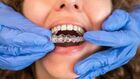 Achieve a Confident, Straighter Smile with Invisalign in Geneva