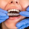 Achieve a Confident, Straighter Smile with Invisalign in Geneva