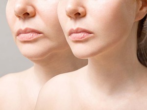 Dermal Fillers: A Closer Look at the Game-Changer in Oahu Cosmetic Enhancement