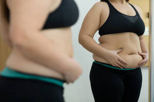 Achieving Long-Term Success with Weight Loss Surgery