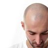 Get FUE Hair Transplant By an Expert Surgeon