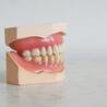Complete vs. Partial Dentures: Which Is Right for Lewisville Residents?