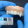 What are the eligibility criteria for implant dentures?
