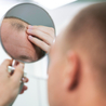 Simple Steps to Control and Prevent Hair Loss