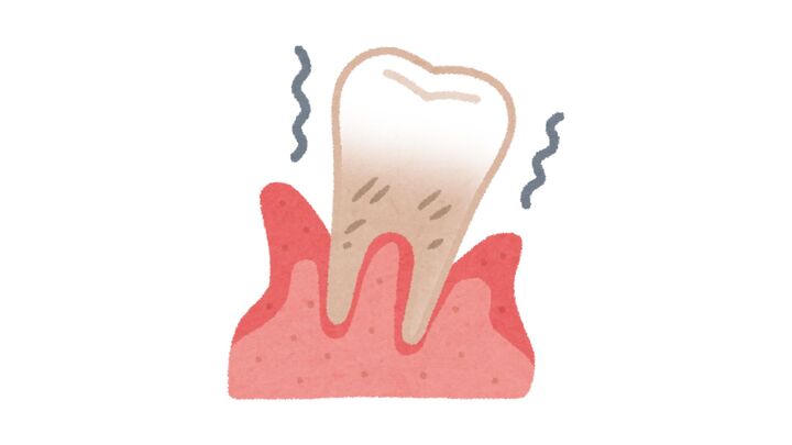 The Silent Threat of Periodontal Disease: Why It’s Critical to Address Gum Health Early