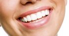 How Often Should You Whiten Your Teeth?