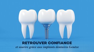 Retrouver confiance et sourire gr\u00e2ce aux implants dentaires Gen\u00e8ve