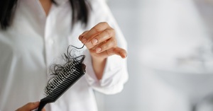 Teenage Hair Fall: Causes, Myths, and Facts