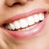 How Often Should You Whiten Your Teeth?