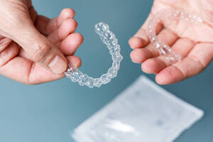 Top Reasons to Choose Invisalign Over Traditional Braces for Your Smile Transformation