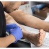 Finding the Right Specialist for Varicose Vein Treatment: Tips and Advice
