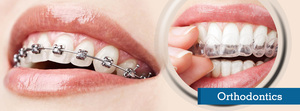 Best Orthodontic treatment in Jaipur