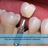 Osseointegration Implants Market Size, Share, Trends, Growth, Industry Analysis Report and Forecast 2022-2027