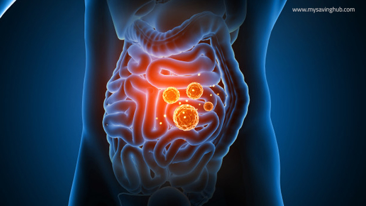 Foods That Cause Gut Problems and How to Fix It 
