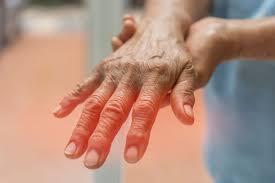 Managing Dysesthesia: Treatment Tools That Help 