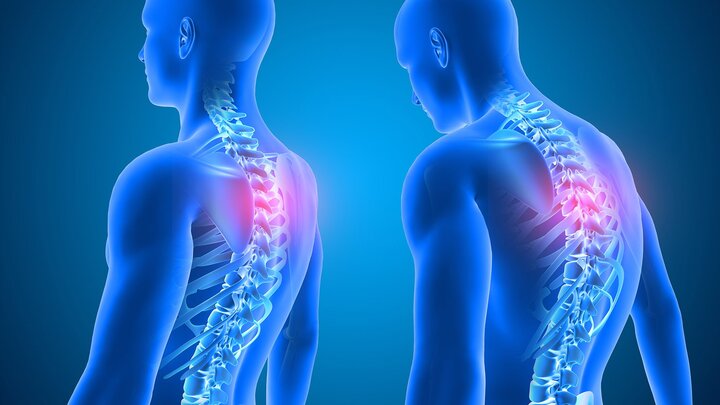 Spine Treatment Options: Understanding the Best Approach for Your Condition