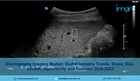 Elastography Imaging Market Report 2024 | Size, Share, Top Companies &amp; Forecast by 2032 \u2013 IMARC Group