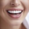 What Are The Benefits Of Full Mouth Reconstruction?