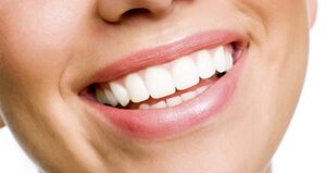 What Are Types Of Teeth Whitening Options?