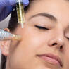 Microneedling for Acne Scars: A Magical Solution to Reclaim Your Skin