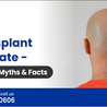 Hair Transplant Success Rate \u2013 What To Expect, Myths and Facts