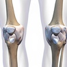Knee Pain: Causes And Pain Treatment