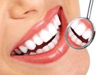 Braces Vs. Invisalign In Singapore: Which Is The Better Choice?