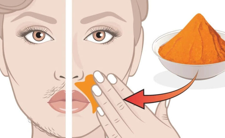 Natural Ways to Get Rid of Facial Hair