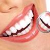Braces Vs. Invisalign In Singapore: Which Is The Better Choice?