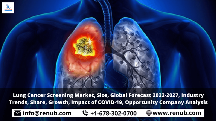 Lung Cancer Screening Market, Industry Trends, Share, Insight, Growth, Global Forecast 2022-2027