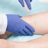 What Treatments Available For Vein Disorder?