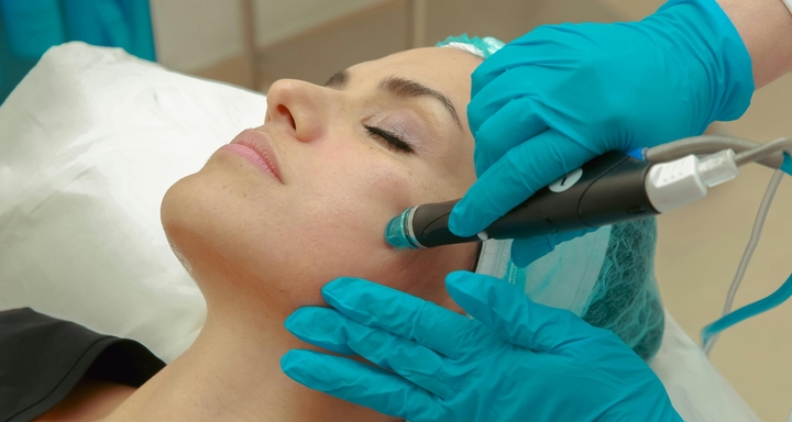 Glow Instantly: Why HydraFacial Is the Celebrity Skincare Secret